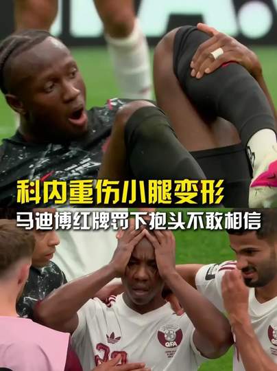加拿大悍将小腿恐怖变形!C罗接班人险断腿,赛后一幕令人动容